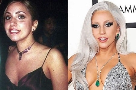 A before and after picture of Lady Gaga.